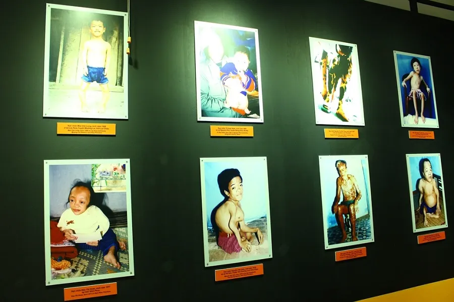 Images of cases of deformities caused by Agent Orange exposure
