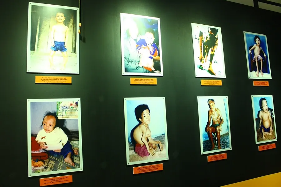 Images of cases of deformities caused by Agent Orange exposure